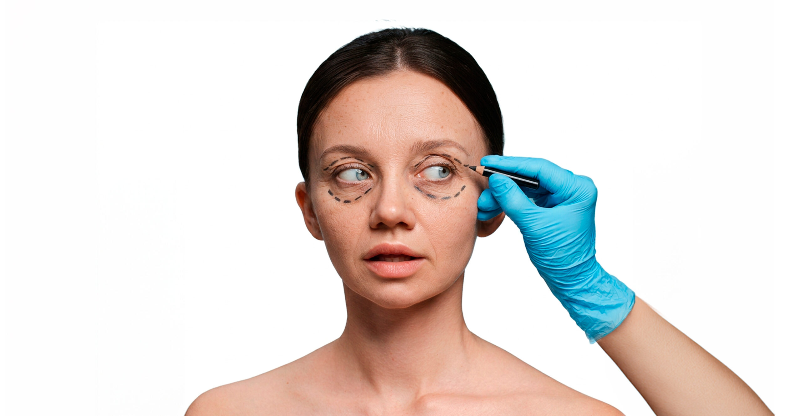 Blefaroplastia Bogotá
