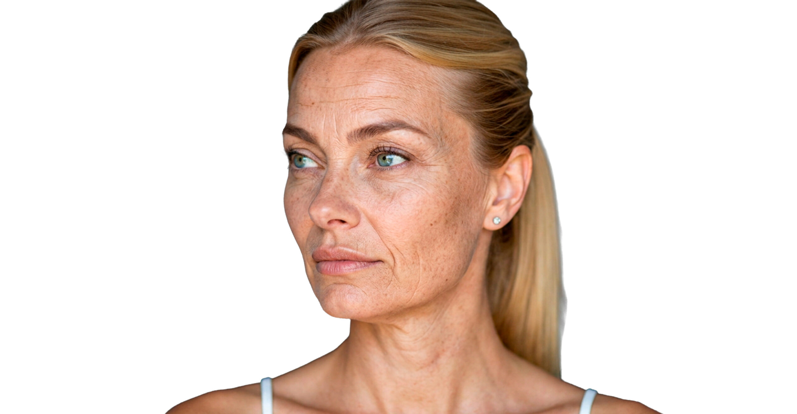 Candidatos lifting facial