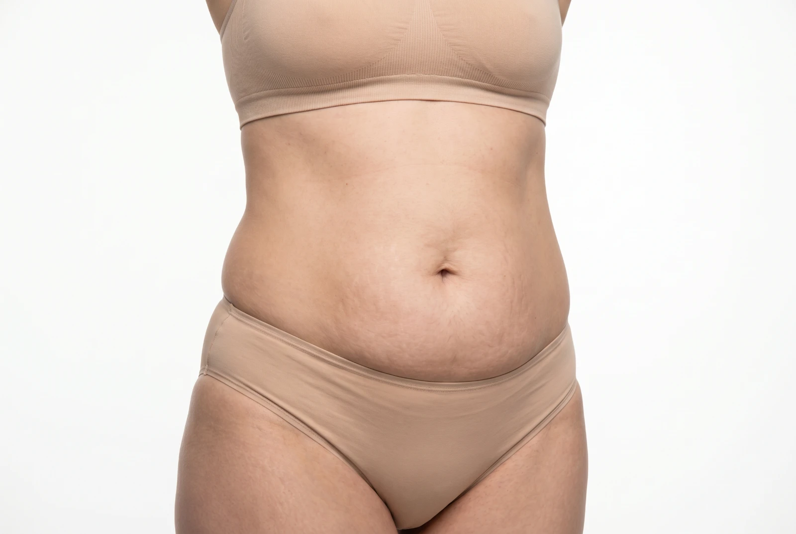 Abdomen con flacidez y exceso de piel, candidata a abdominoplastia