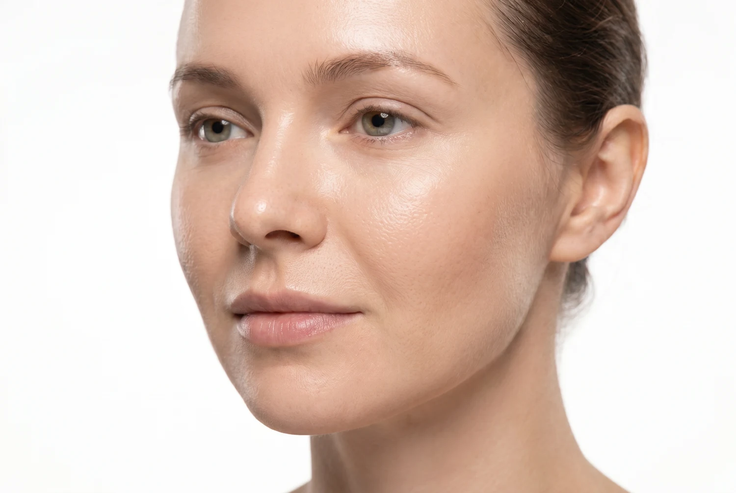 Efecto lifting de los hilos tensores