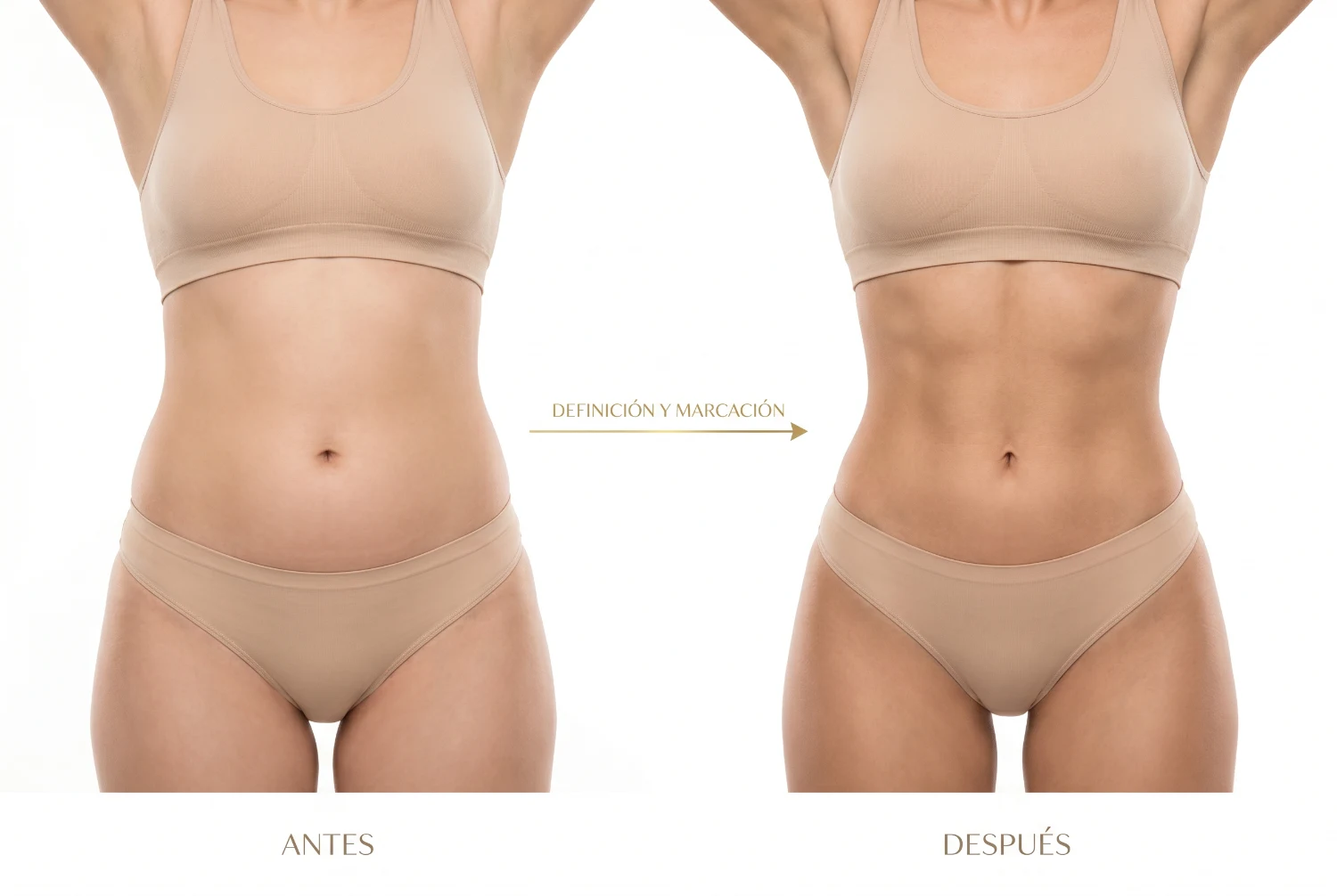 Marcación abdominal: antes y después